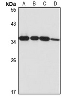 Anti-TINP1 Antibody