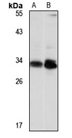 NSMCE1 antibody