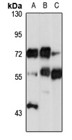 Anti-NT5C2 Antibody