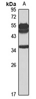 NT5C3 antibody