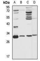 Anti-NUBP2 Antibody