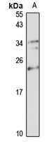 NUDT16 antibody