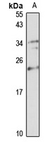 Anti-NUDT16 Antibody