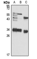 NUDT5 antibody