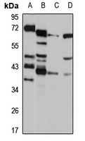 NUDT9 antibody