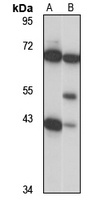 Anti-NUP43 Antibody