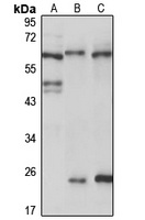 NUP54 antibody