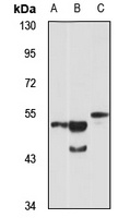 Anti-OLFM3 Antibody