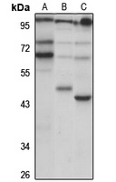 Anti-OLFM4 Antibody