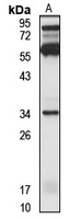 OR2S2 antibody