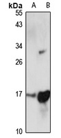 Anti-ORMDL3 Antibody