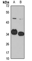 Anti-OTP Antibody