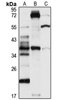 Anti-GPR80 Antibody