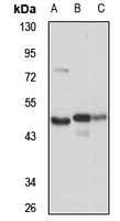 Anti-OXSM Antibody