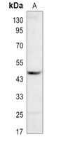 P4H-TM antibody