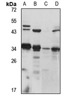 PACRG antibody