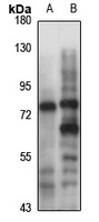 PADI2 antibody