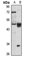 PAFAH alpha antibody