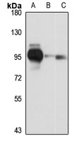 Anti-PALD1 Antibody