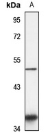 Anti-PARS2 Antibody