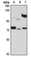 Anti-PATZ1 Antibody