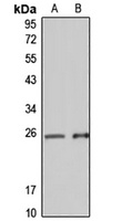 Anti-PCNP Antibody