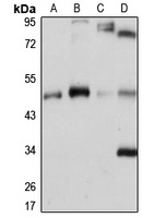 Anti-PCYT2 Antibody