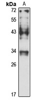 Anti-PDCL Antibody