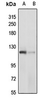 PDE3A antibody
