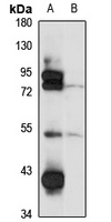 PDE7B antibody