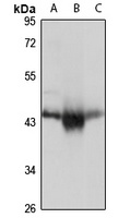 Anti-PDHA2 Antibody