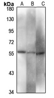 PDIA2 antibody