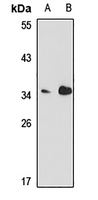 Podoplanin antibody