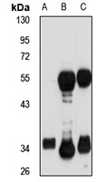 PDXP antibody