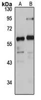 Anti-PDZK2 Antibody
