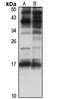 Anti-Perp Antibody