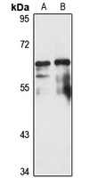 Pescadillo antibody