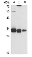 PGAM5 antibody