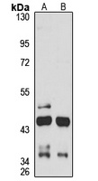 Anti-PHC2 Antibody