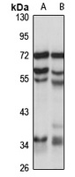 Anti-PHC2 Antibody