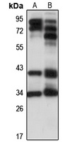 PHF10 antibody