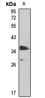 PHF11 antibody