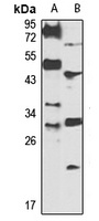 PHF13 antibody