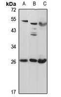 Anti-PID1 Antibody
