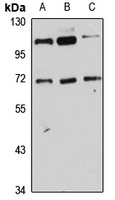 Anti-PIG-T Antibody