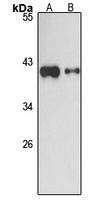 NOP17 antibody