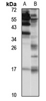 Anti-PLA2G12A Antibody
