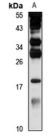 PLA2G16 antibody