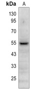 Anti-PLA2G7 Antibody