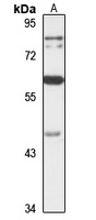 Anti-PLAGL2 Antibody
